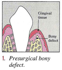 perioSurgery1