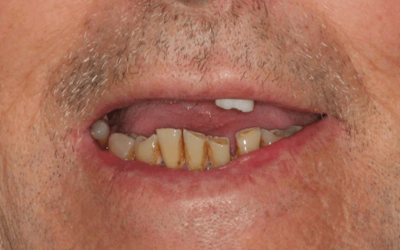 alll-in-four-male-before
