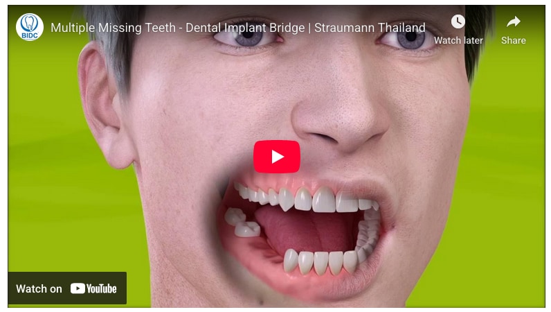 Watch video on YouTube Watch video on YouTube