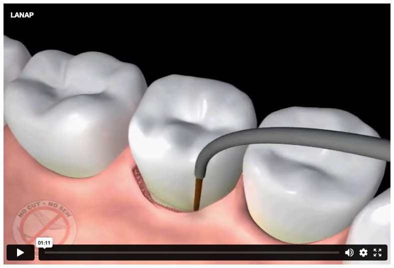 Watch video on Vimeo Watch video on Vimeo